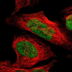 ZNF148 Antibody, Novus Biologicals:Antibodies:Primary Antibodies
